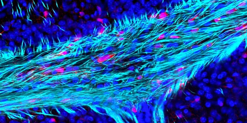 brain’s-‘wiring-insulation’-a-major-factors-of-age-related-brain-deterioration