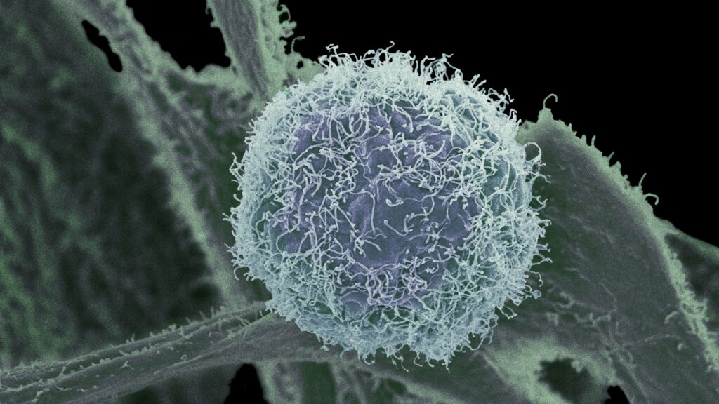 death-rates-are-declining-for-many-common-cancers-in-us.