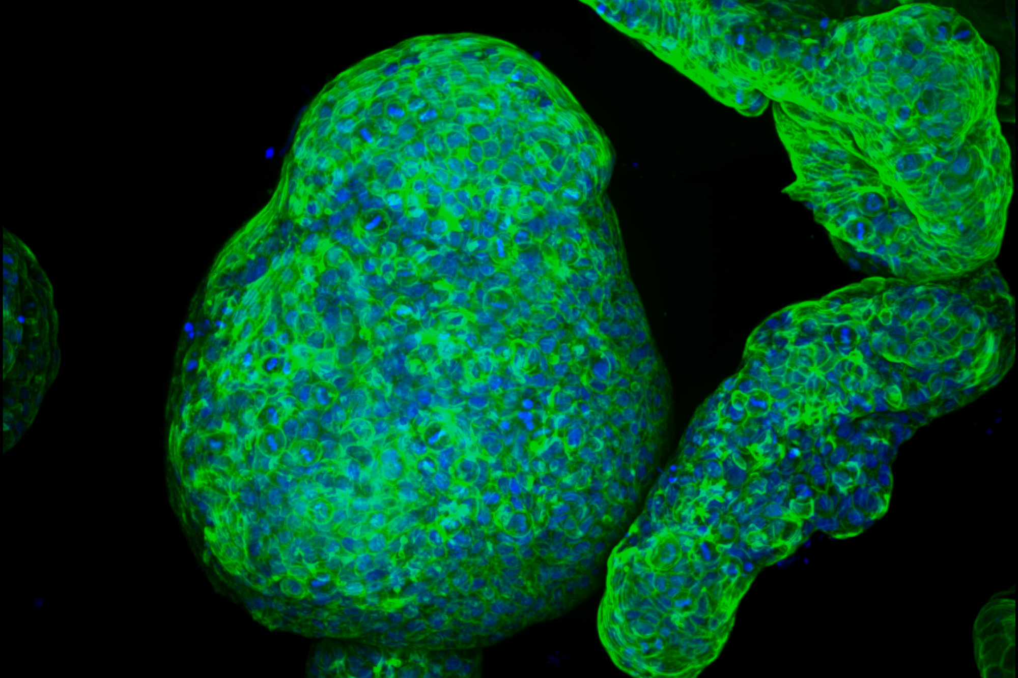 engineers-grow-pancreatic-organoids-that-mimic-the-real-thing