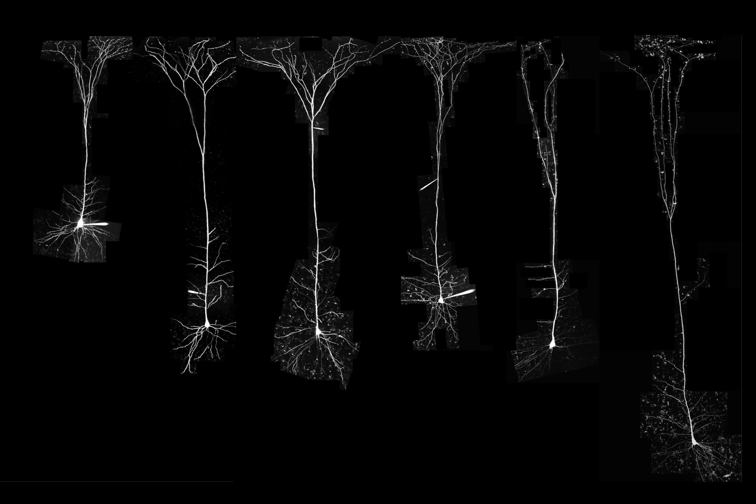 study-finds-a-striking-difference-between-neurons-of-humans-and-other-mammals