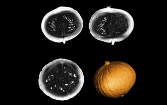 the-most-powerful-mri-scanner-in-the-world-delivers-its-first-images