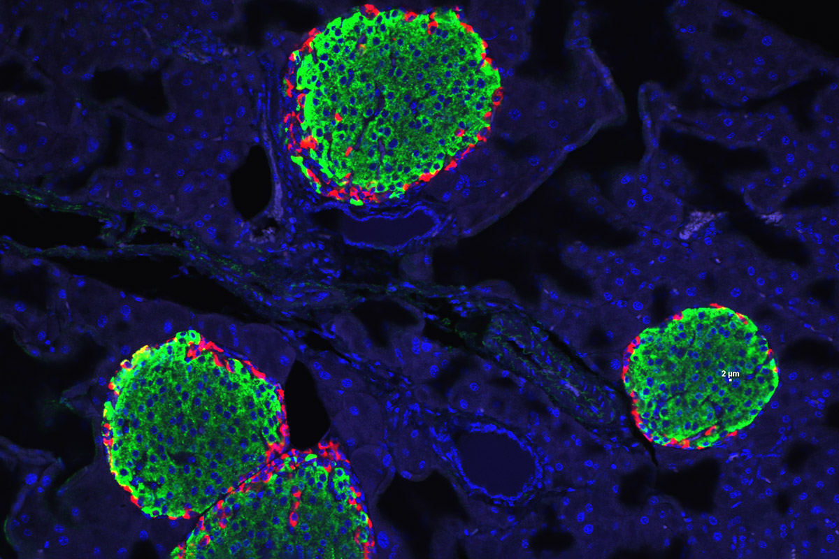 newly-identified-hormone-may-be-a-critical-driver-of-type-1-and-type-2-diabetes