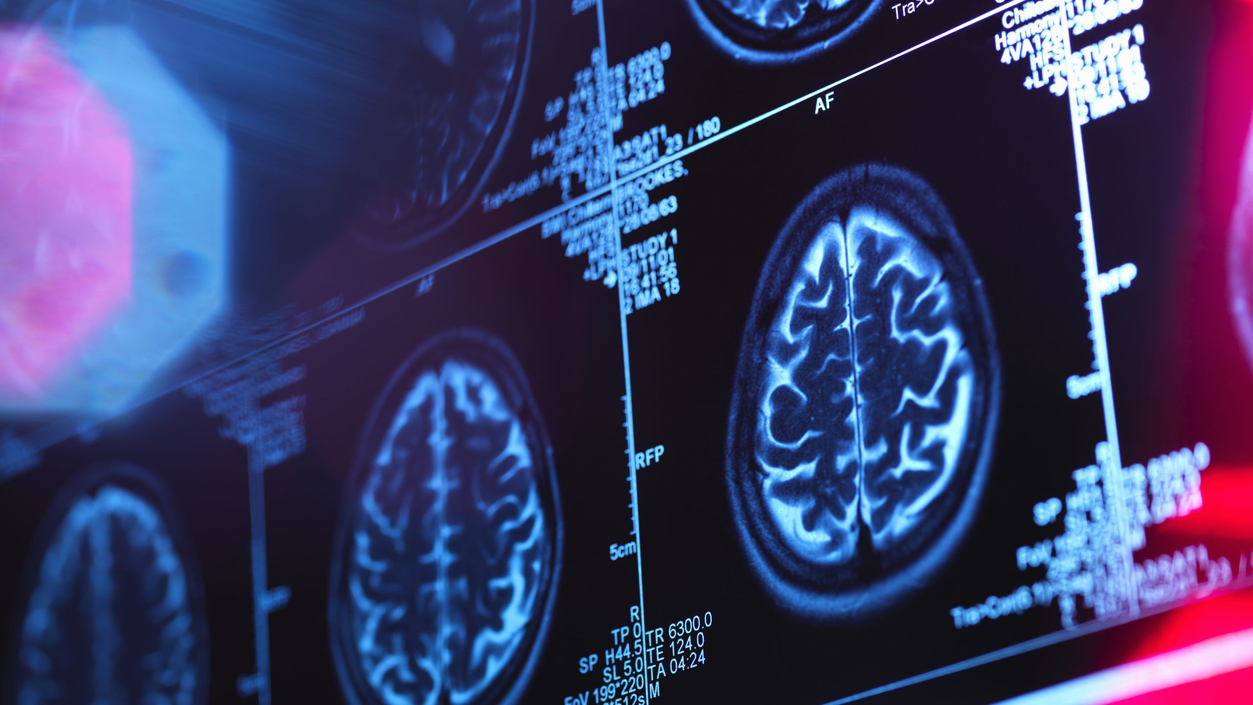 brain-charts:-mapping-the-rapid-growth-and-slow-decline-of-the-brain-over-life