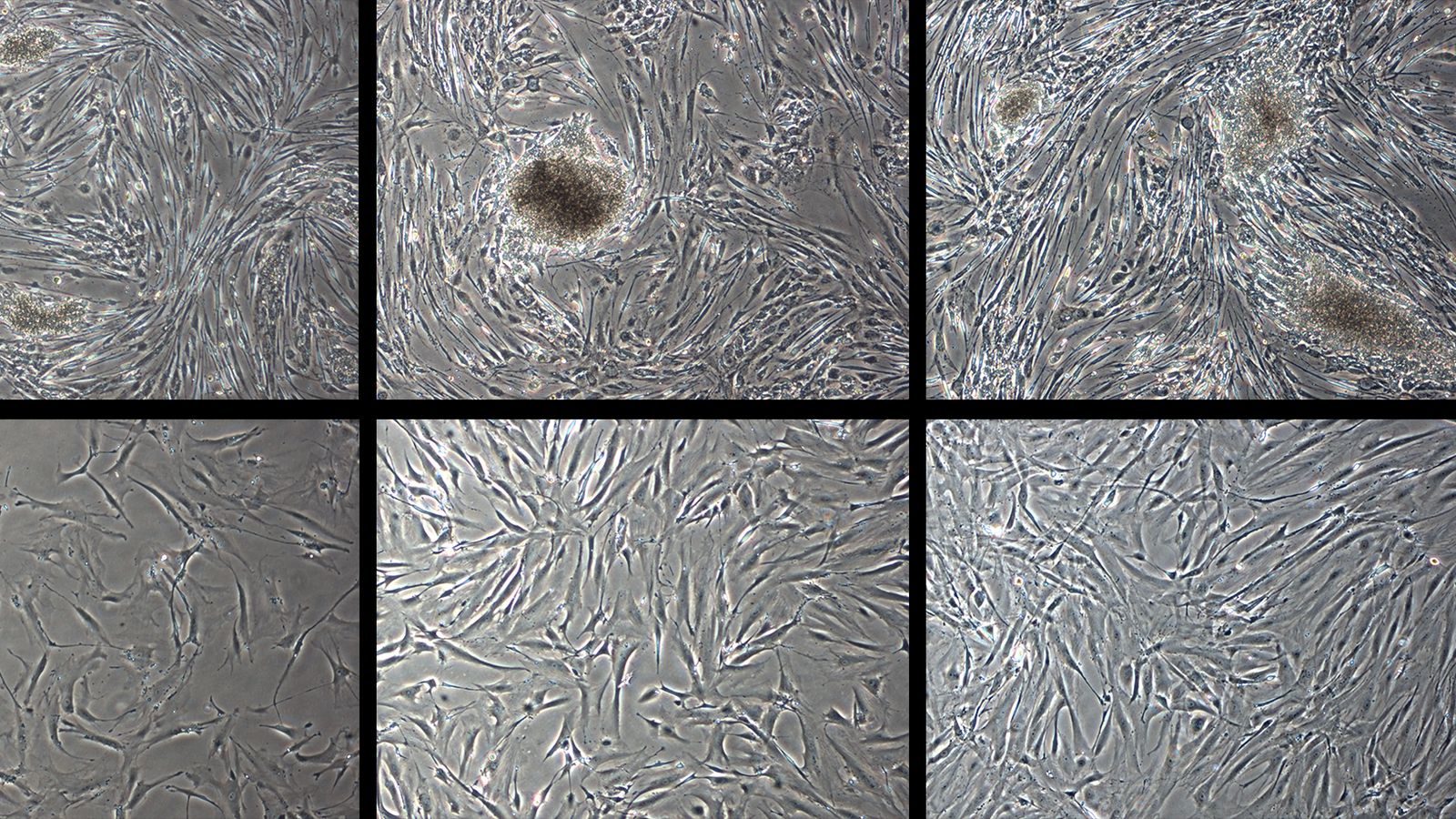 turning-back-the-clock:-human-skin-cells-de-aged-by-30-years-in-trial