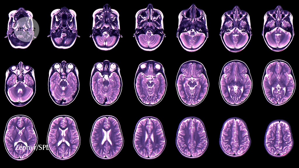 the-brain-expands-and-shrinks-over-time