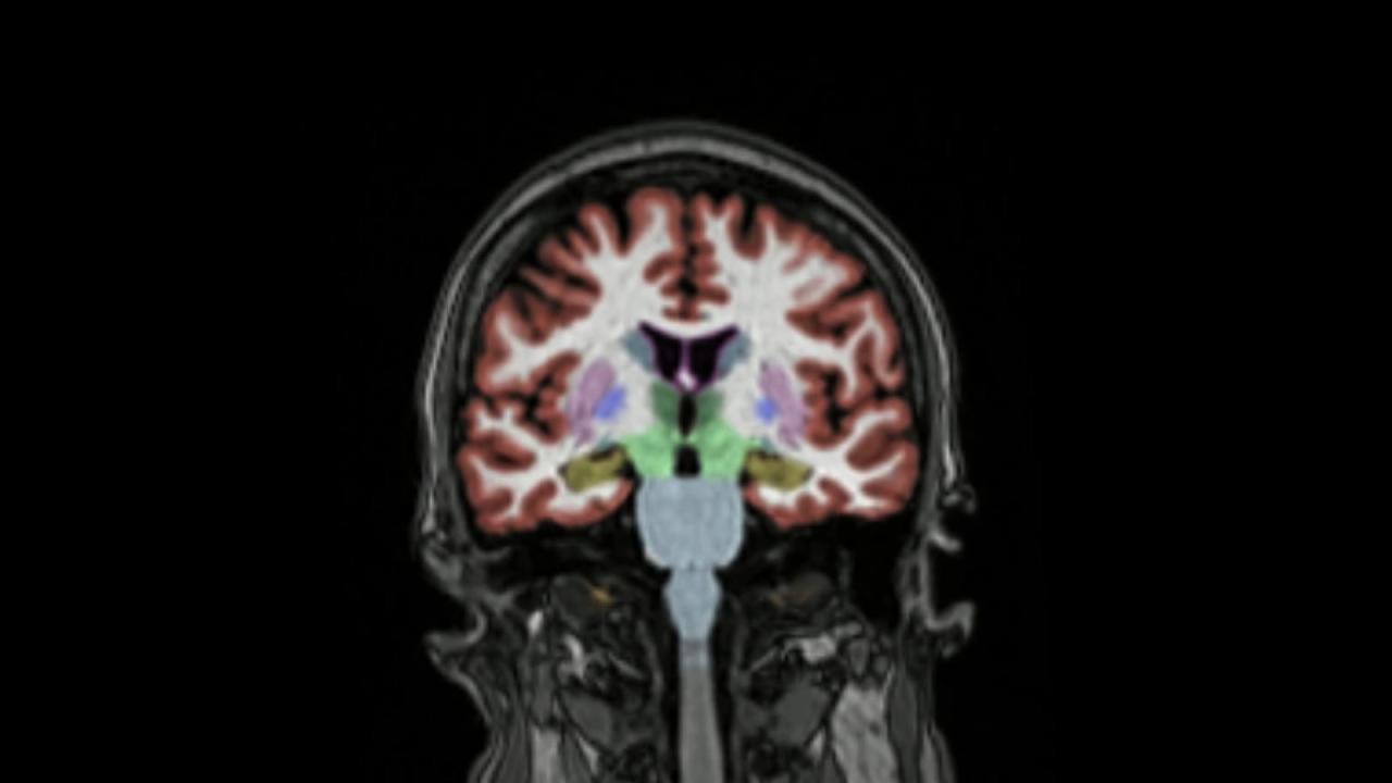 missing-link-between-alzheimer’s-and-vascular-disease-found?