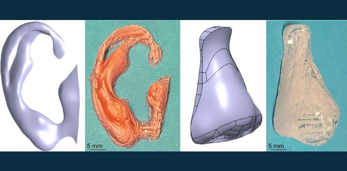 researchers-discover-way-to-3d-print-directly-inside-the-body-without-surgery