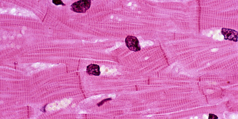 pig-heart-transplant-failed-as-its-heart-muscle-cells-died