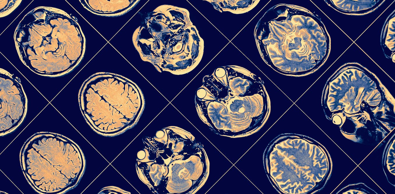 people-who-are-isolated-from-others-do-worse-on-cognitive-tests:-new-research