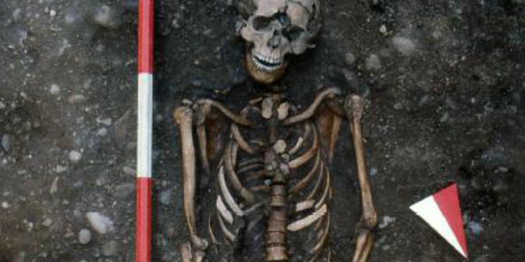 medieval-skeleton-puts-a-face-on-accounts-of-torture-and-violence-(2019)