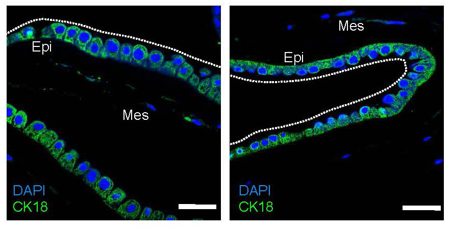in-some-instances-the-fetus-helps-repair-a-ruptured-amniotic-sac