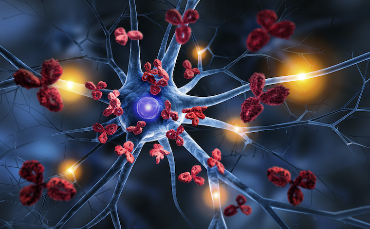 multiple-sclerosis-discovery-could-end-disease’s-chronic-inflammation