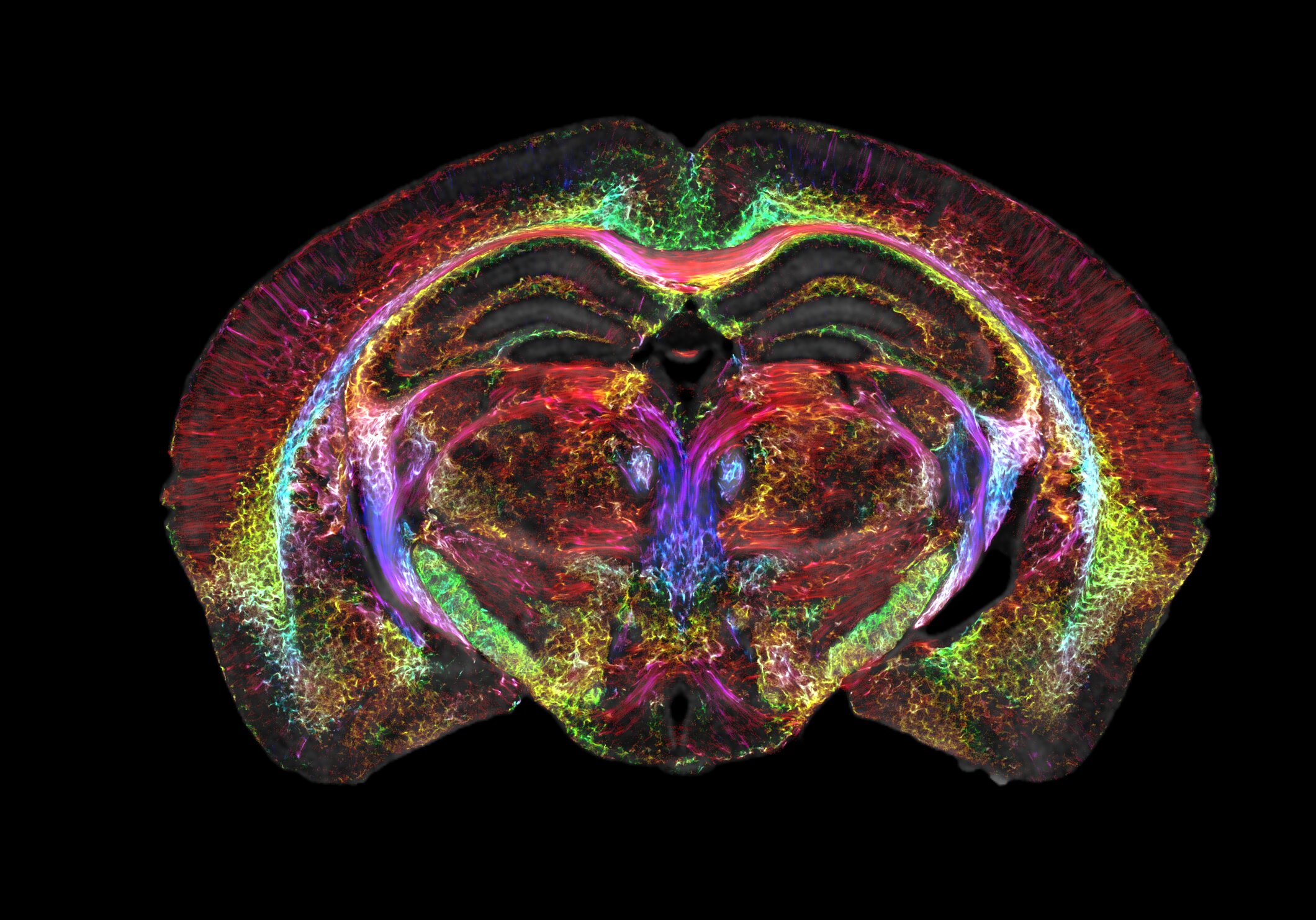 brain-images-just-got-64-million-times-sharper
