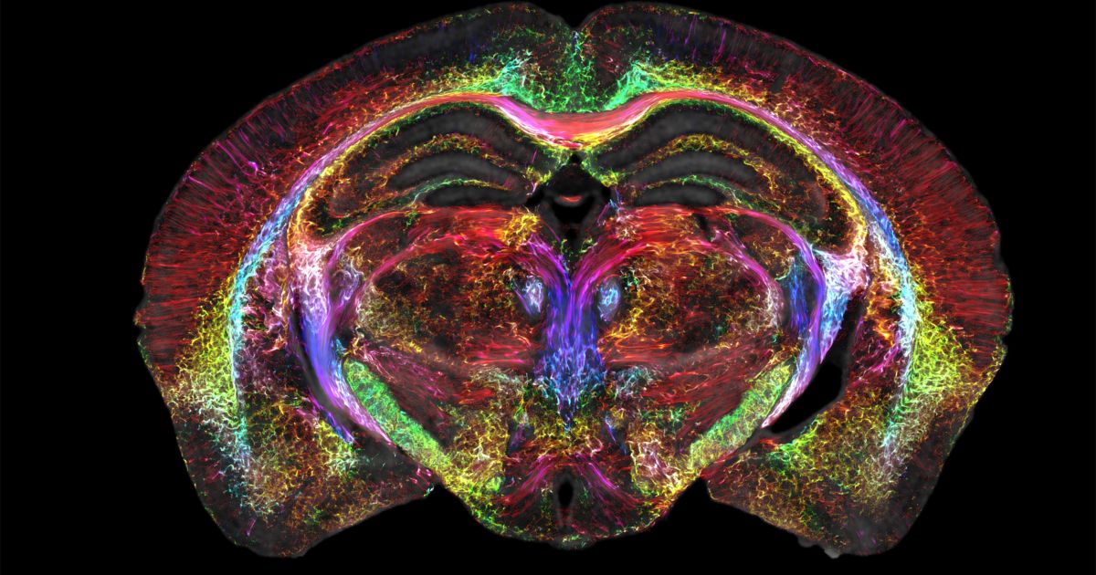 mri-brain-images-just-got-64m-times-sharper