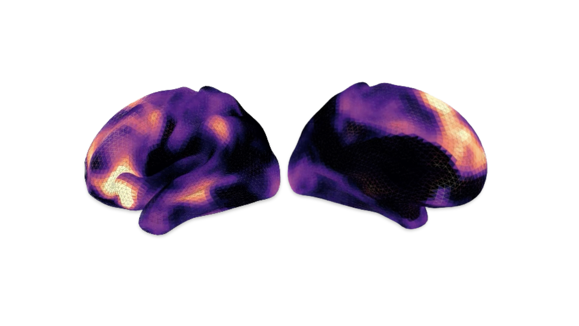 researchers-treat-depression-by-reversing-brain-signals-traveling-the-wrong-way
