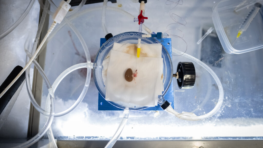 scientists-unfroze-rat-organs-and-transplanted-them
