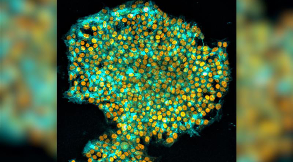 scientists-find-way-to-wipe-a-cell’s-memory-to-reprogram-it-as-a-stem-cell