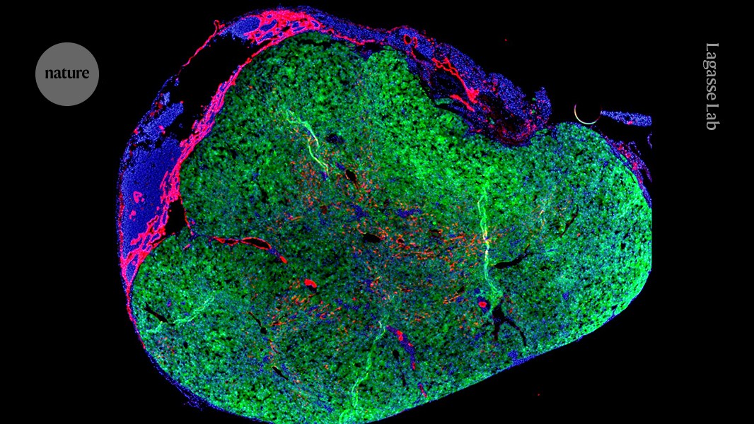 ‘mini-liver’-will-grow-in-person’s-own-lymph-node-in-bold-new-trial