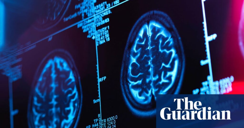second-canadian-scientist-alleges-brain-illness-investigation-was-shut-down