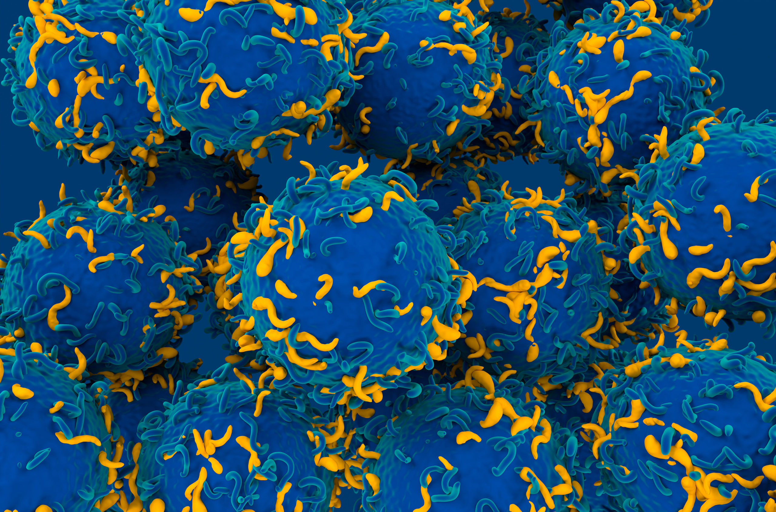 scientists-discover-a-cause-of-lupus,-possible-way-to-reverse-it