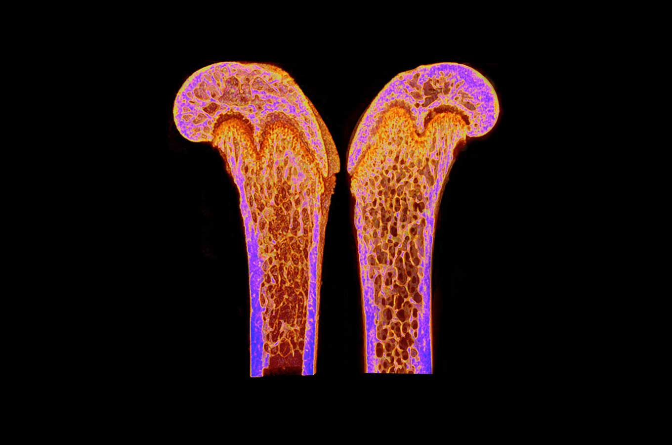 scientists-discover-a-new-hormone-that-can-build-strong-bones