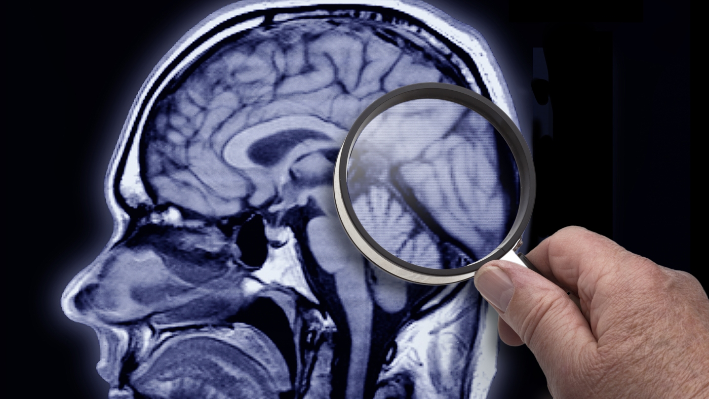 the-protein-reelin-keeps-popping-up-in-brains-that-resist-aging-and-alzheimer’s