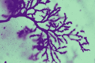 knocking-out-one-key-gene-leads-to-autistic-traits