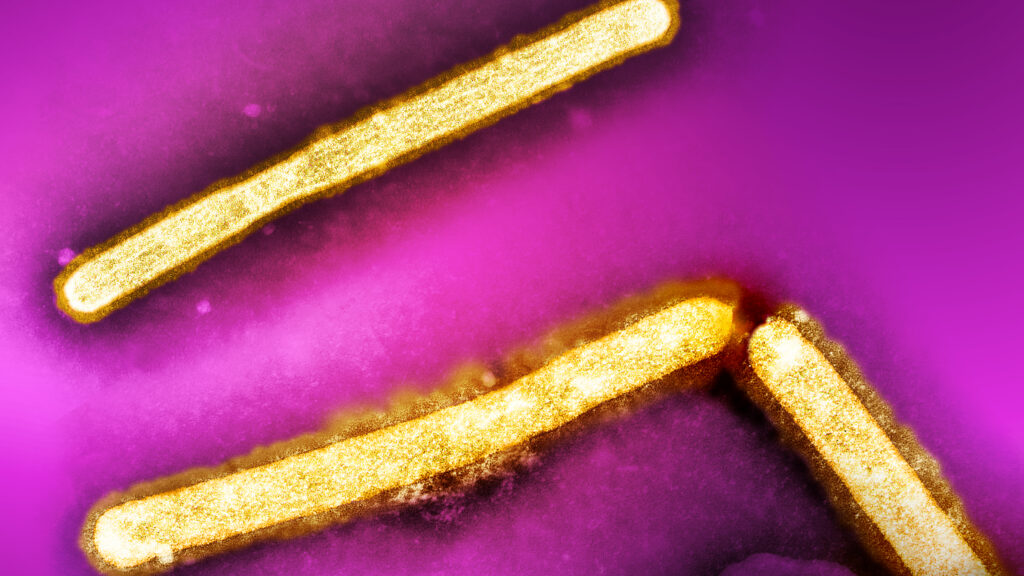 four-more-health-care-workers-ill-after-caring-for-bird-flu-case-in-missouri
