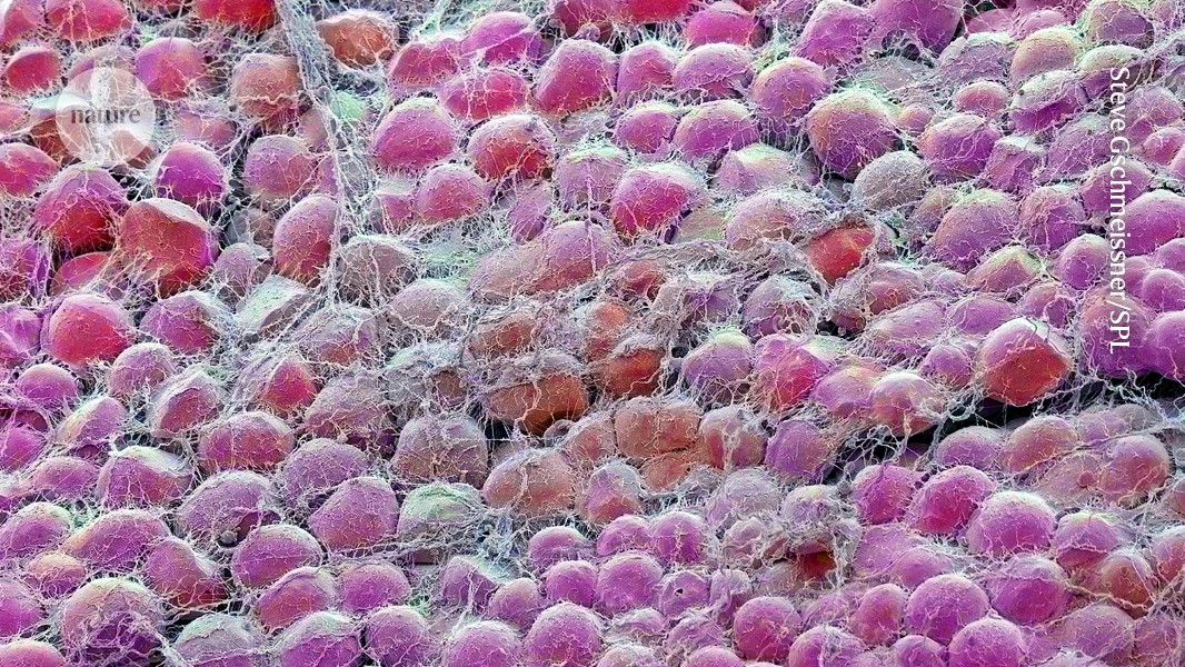 eating-less-can-lead-to-a-longer-life:-study-in-mice-shows-why