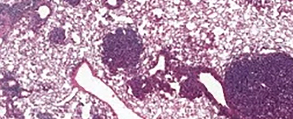 the-risk-of-cancer-fades-as-we-get-older,-and-we-may-know-why