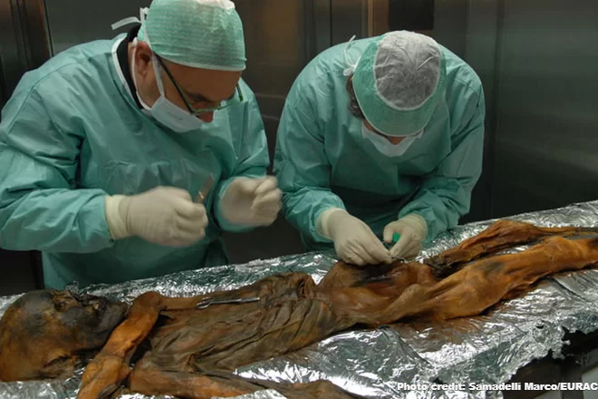 otzi,-the-4000-year-old-iceman-mummy,-had-lyme-disease