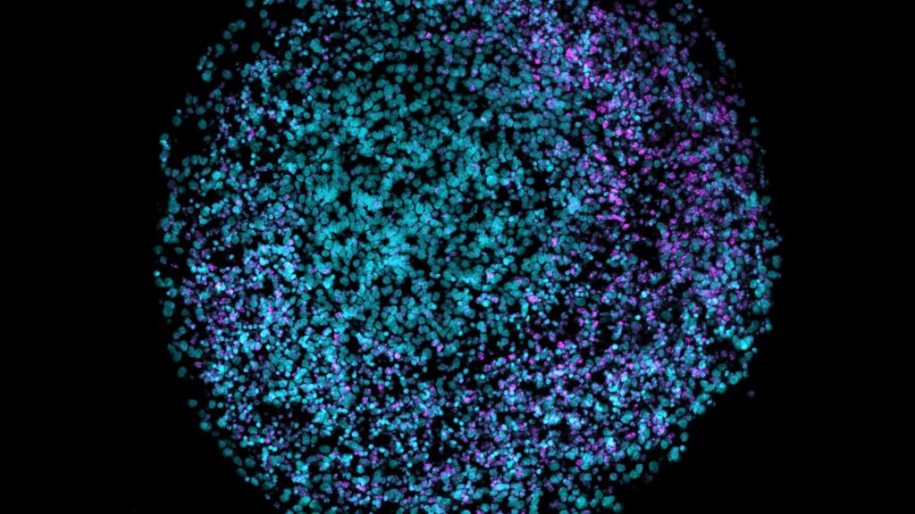 scientists-find-links-between-alzheimer’s,-herpes,-and-head-trauma