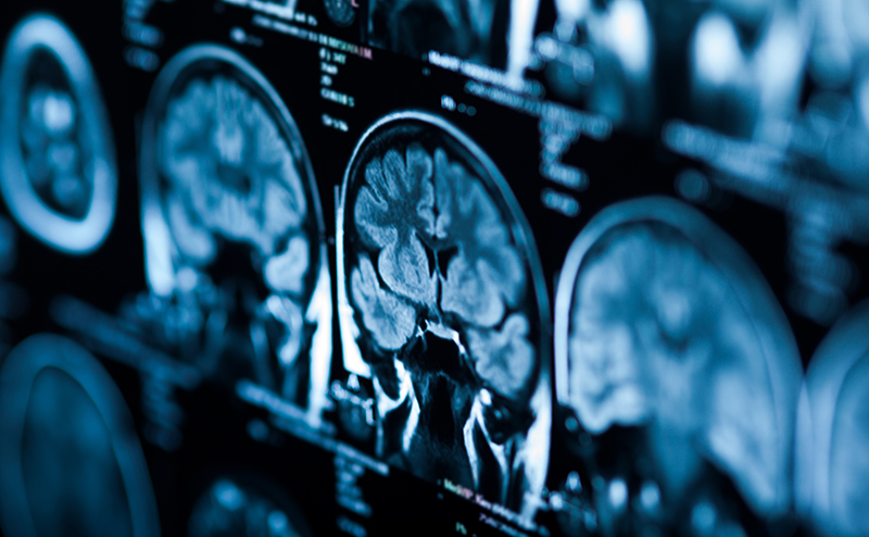 world-first-experimental-cancer-treatment-paves-way-for-clinical-trial