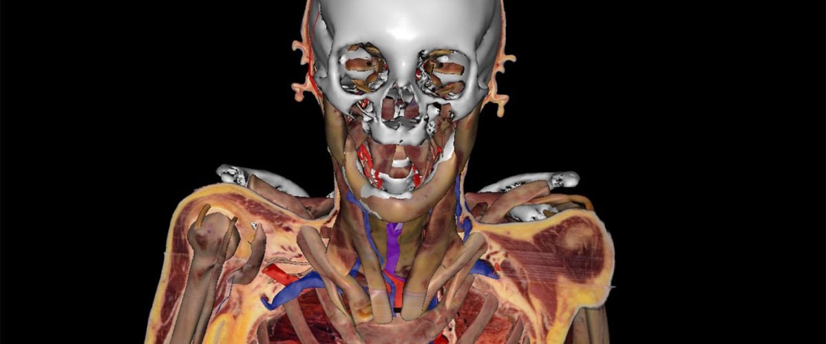 virtual-human-–-a-living-cadaver-–-pushes-boundaries-of-anatomical-science(2018)