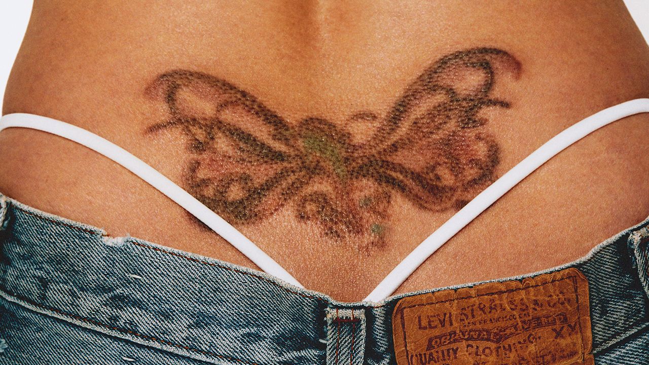 more-people-are-getting-their-tattoos-removed