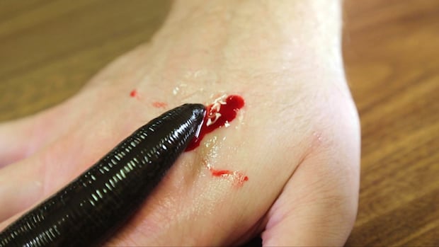 you-shouldn’t-salt-a-leech-that’s-sucking-your-blood-(2019)