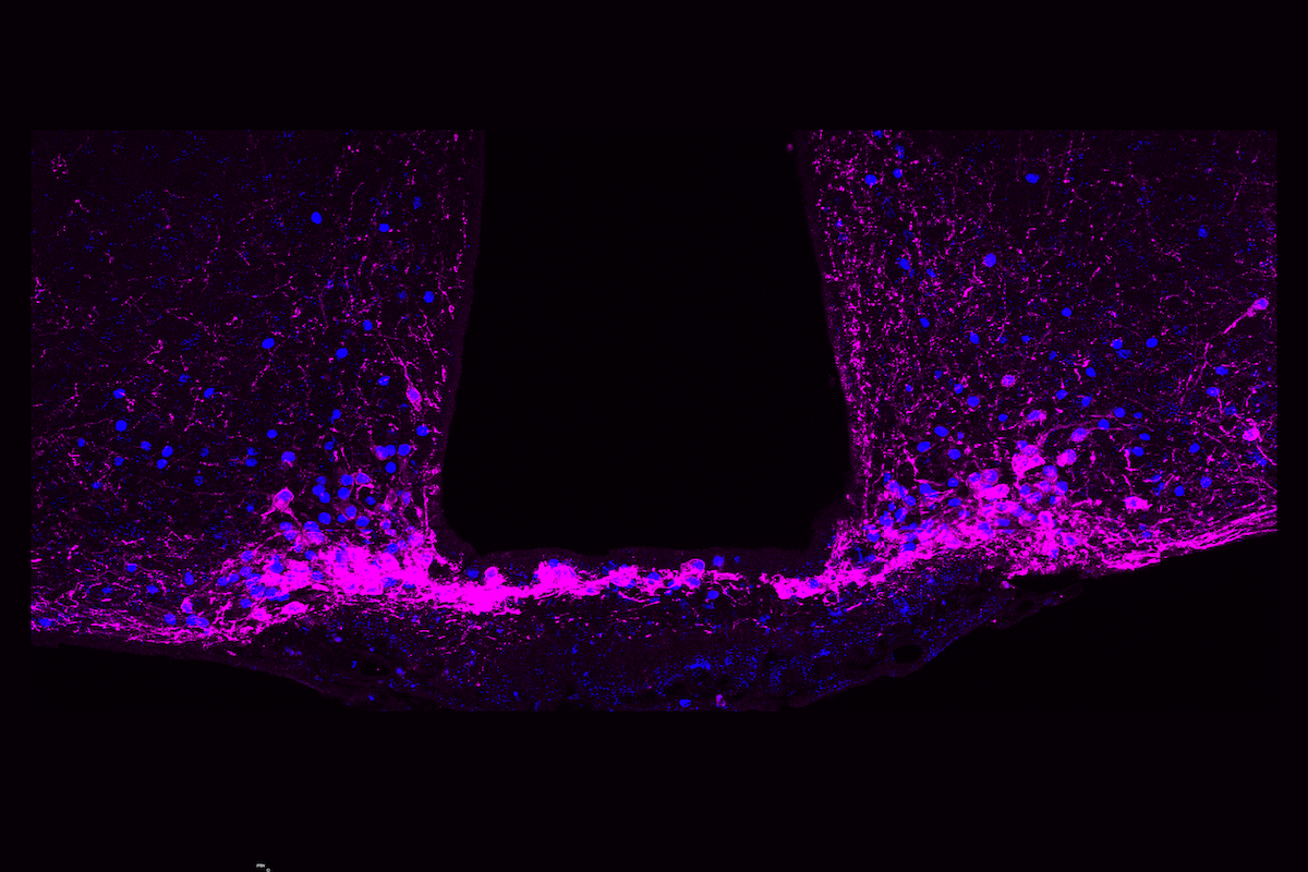 a-built-in-‘off-switch’-to-stop-persistent-pain