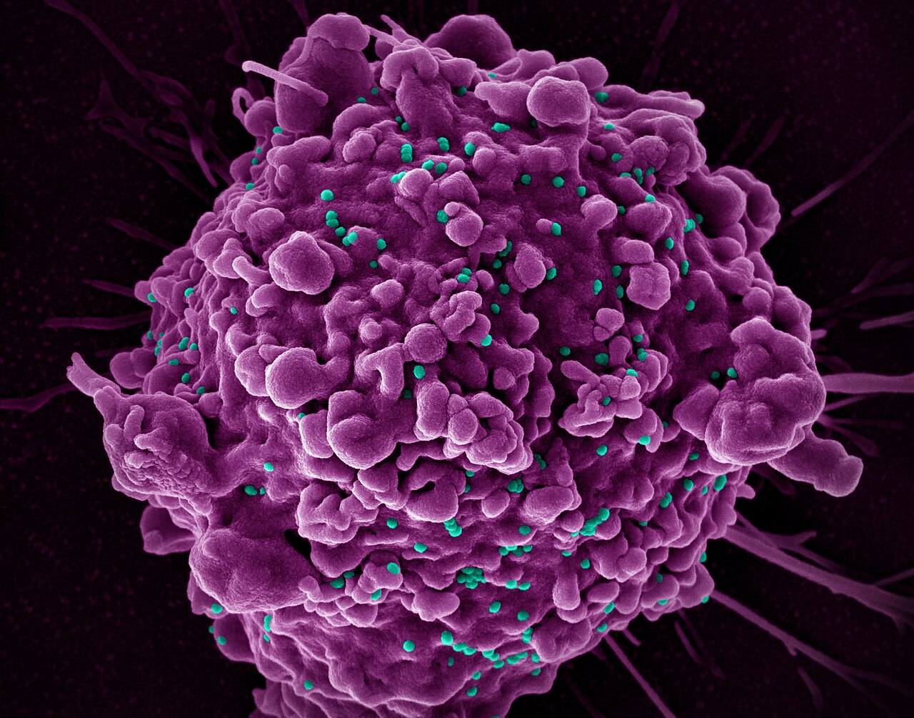 new-hiv-vaccine-shows-unprecedented-success-in-preclinical-study