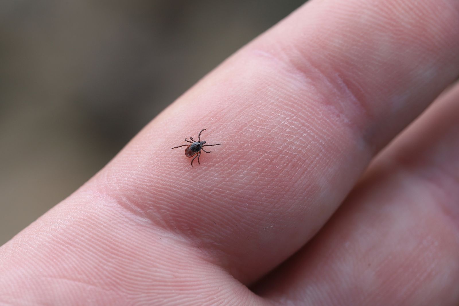the-first-at-home-test-for-infected-ticks-could-improve-lyme-disease-diagnosis