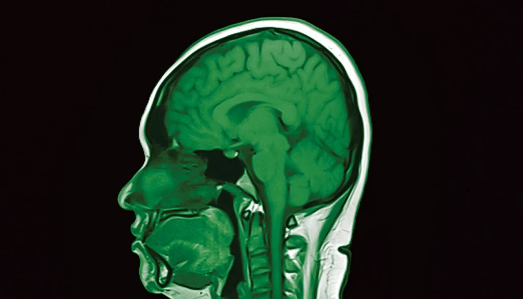 first-human-trials-of-designer-protein-therapies-stun-us-neuroscientists