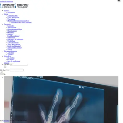 OsteoporosNytt startsida 2023